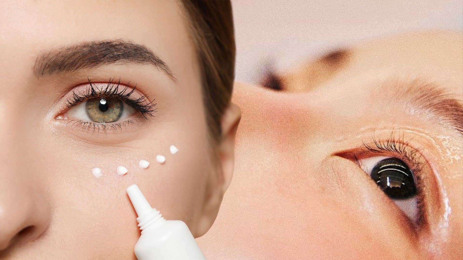 Liệu các giải pháp làm đẹp có thể đẩy lùi quầng thâm quanh mắt?