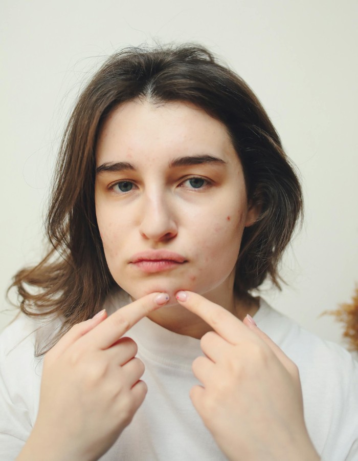 Hinh anh Có Tết 2026: Đâu là những liệu trình spa giúp “F5” làn da sau Tết? 4