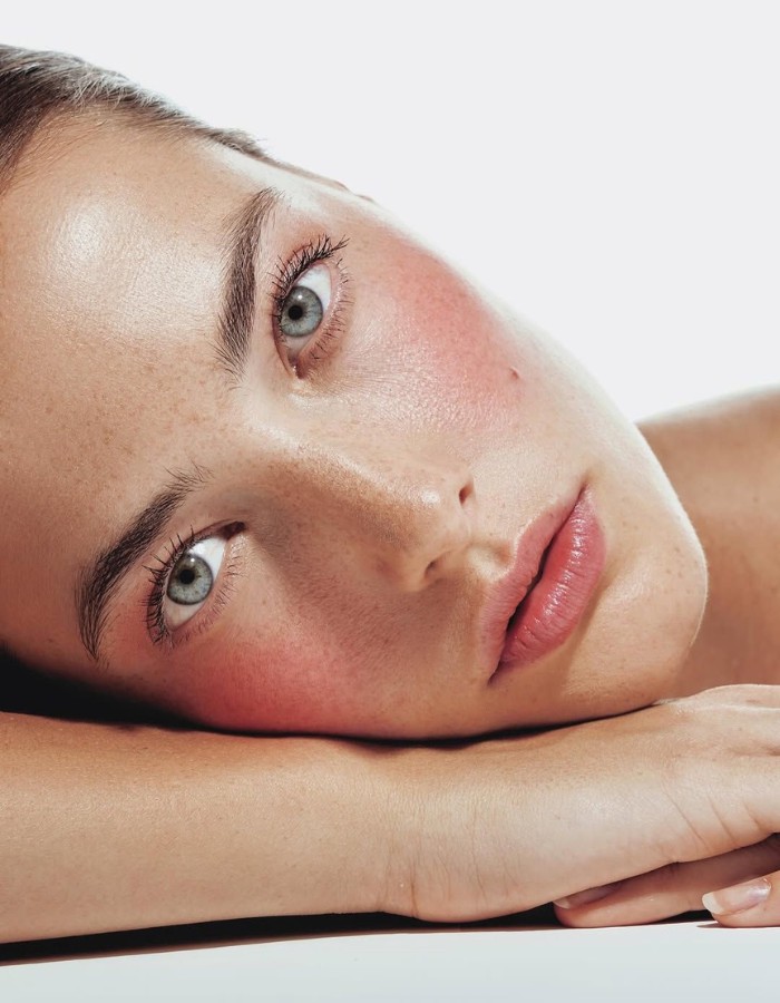 Hinh anh Vì sao liệu trình trị mụn của bạn không thật sự hiệu quả?  7